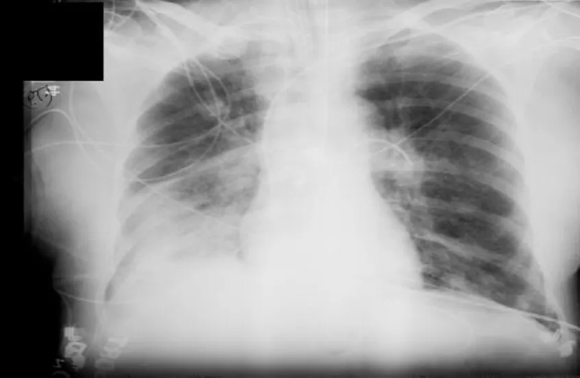 ما مدى خطورة الأشعة السينية على الصحة؟